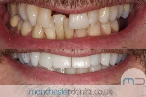 Teeth-Whitening-with-URL_0001_Whitening work gallery (2) Teeth-Whitening-with-URL_0001_Whitening work gallery (2)