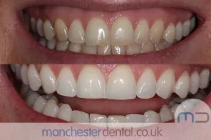 Teeth-Whitening-with-URL_0001_Whitening work gallery (3) Teeth-Whitening-with-URL_0001_Whitening work gallery (3)