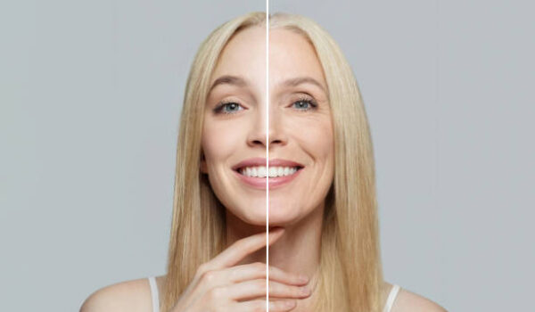 Blonde model woman with young clean skin and wrinkles. Aging and youth, aesthetic surgery, beauty treatment and cosmetology concept