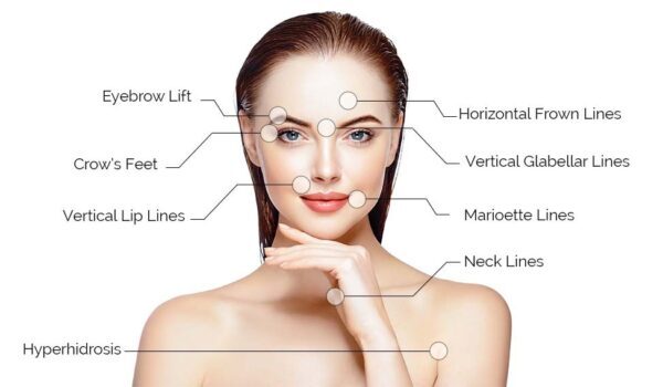 dermal fillers-manchester dental img