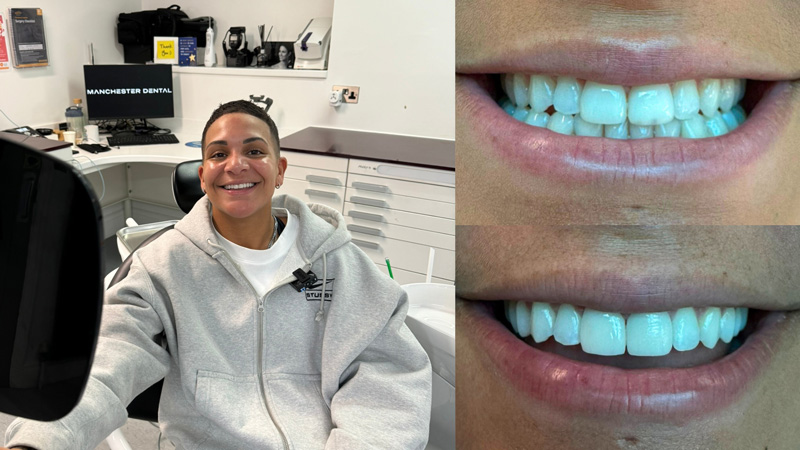 Manchester dental orthodontics work