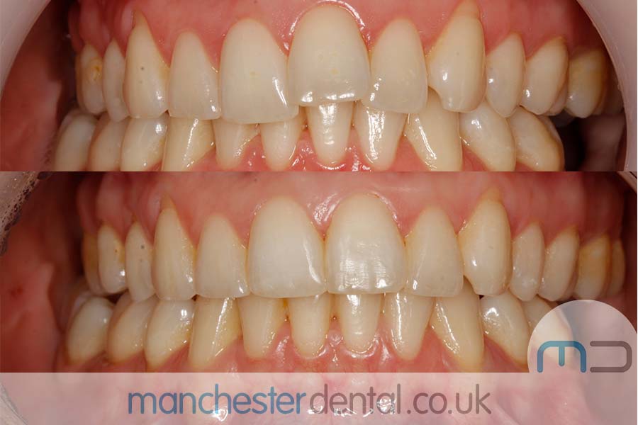 Manchester dental orthodontics work Manchester dental orthodontics work