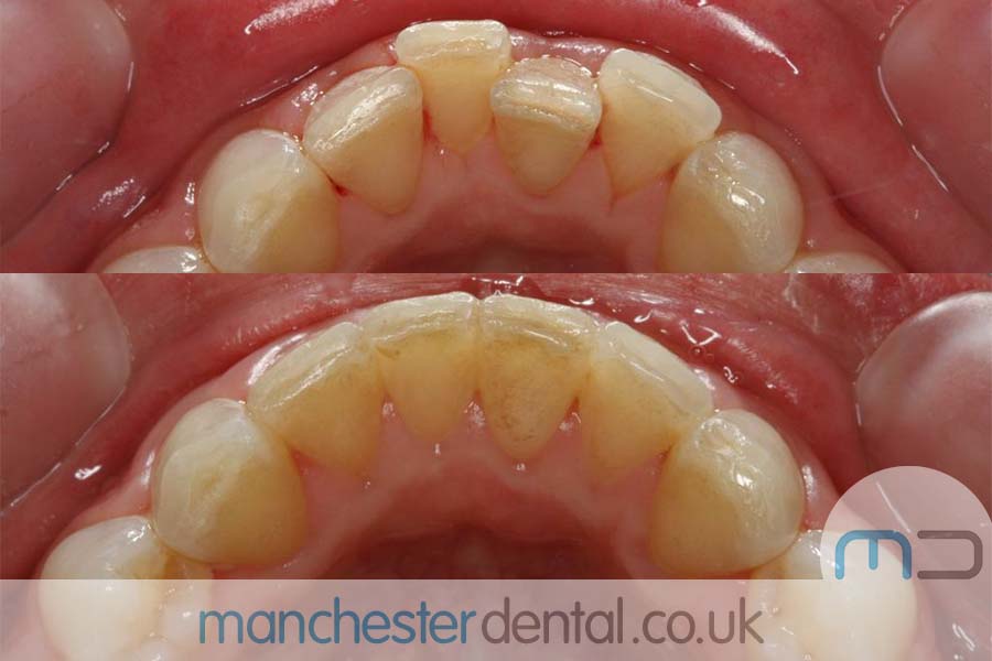 Manchester dental orthodontics work Manchester dental orthodontics work
