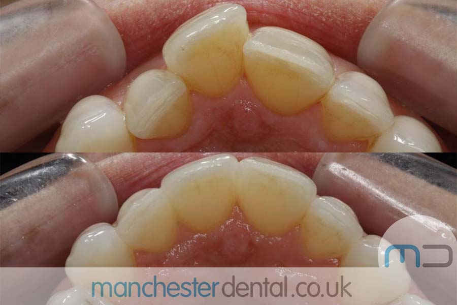 Manchester dental orthodontics work Manchester dental orthodontics work