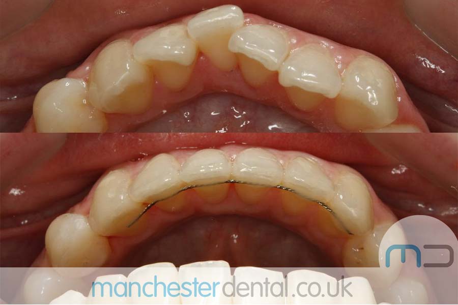 Manchester dental orthodontics work Manchester dental orthodontics work