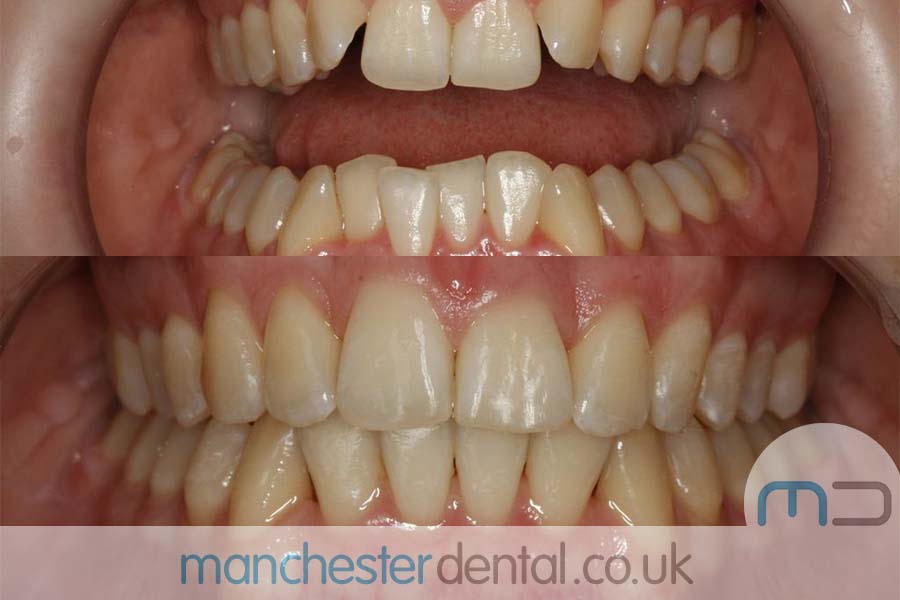 Manchester dental orthodontics work Manchester dental orthodontics work