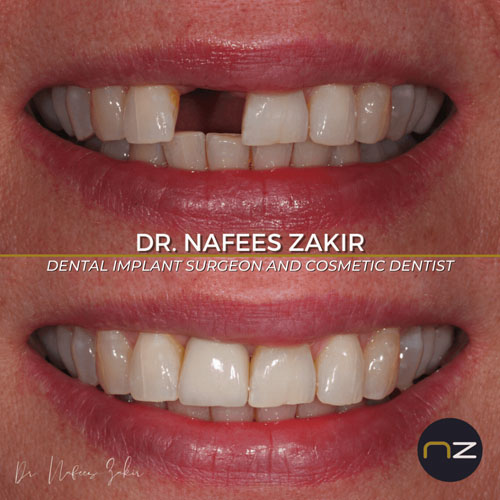 manchester dental work gallery (1) manchester dental work gallery (1)