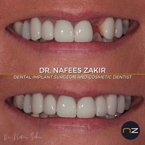 manchester dental work gallery (11) manchester dental work gallery (11)