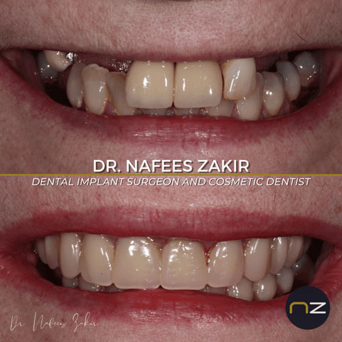 manchester dental work gallery (3) manchester dental work gallery (3)