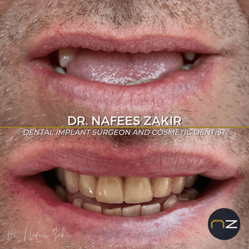 manchester dental work gallery (6) manchester dental work gallery (6)