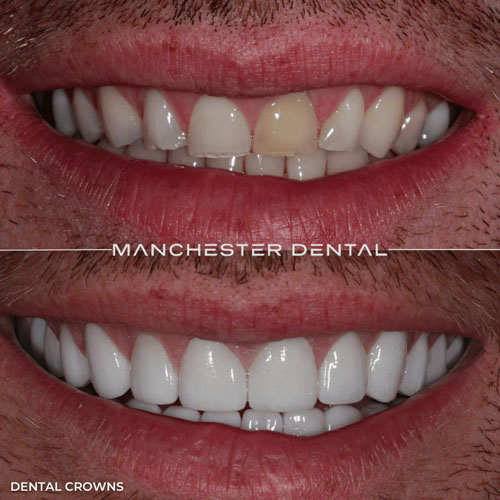 manchester dental work gallery (8) manchester dental work gallery (8)