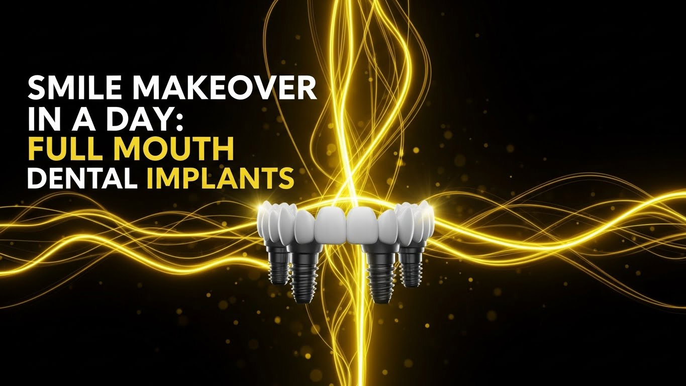 Smile Makeover in a Day: Full Mouth Dental Implants 